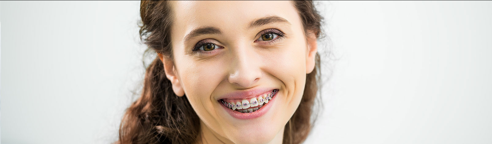 Braces in Turkey