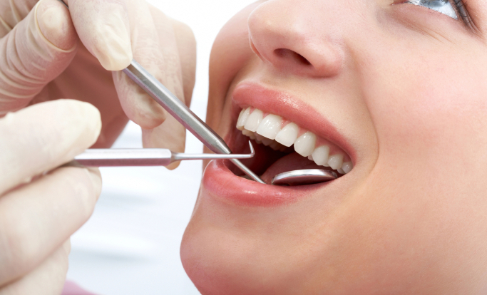 Dental Fillings: The Benefit of Detecting Tooth Decay Early