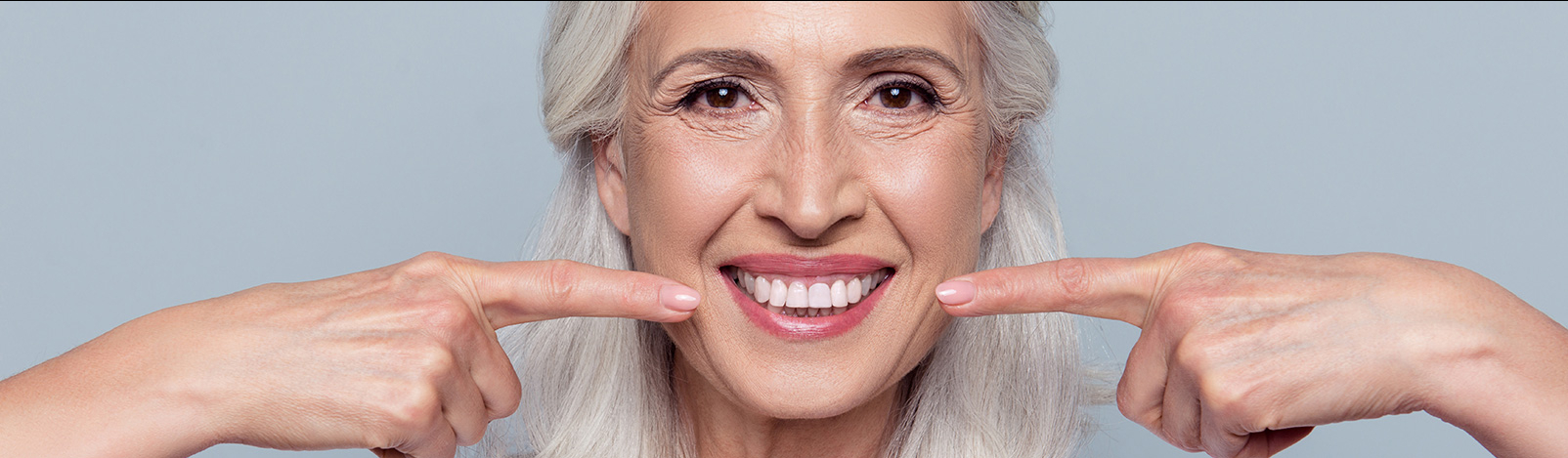 Implant dentaire à bouche complète